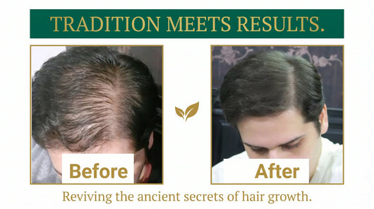 Riwayat Hair Revival Oil – Herbal Root Nourishing Hair Care Oil