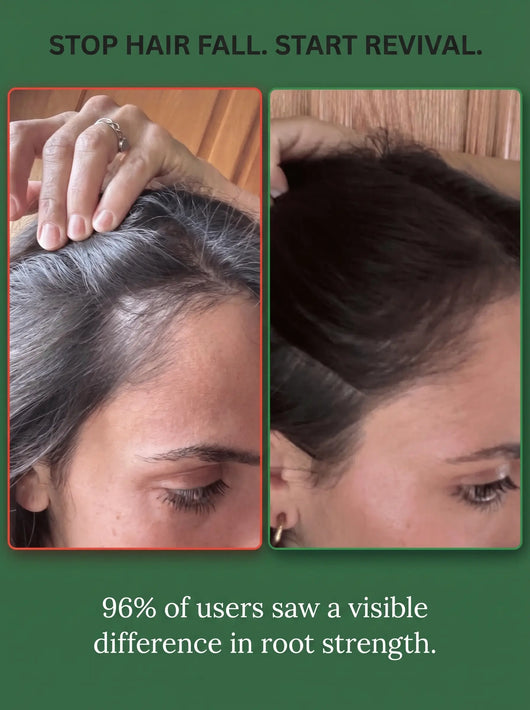 Riwayat Hair Revival Oil – Herbal Root Nourishing Hair Care Oil