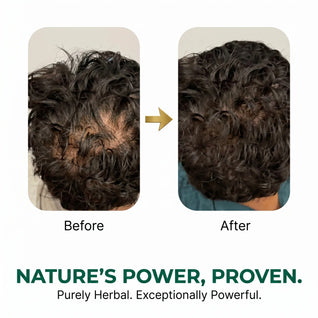Riwayat Hair Revival Oil – Herbal Root Nourishing Hair Care Oil