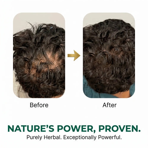 Riwayat Hair Revival Oil – Herbal Root Nourishing Hair Care Oil