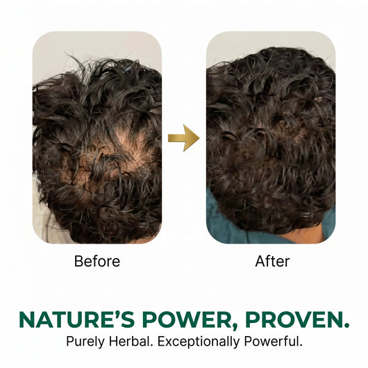 Riwayat Hair Revival Oil – Herbal Root Nourishing Hair Care Oil