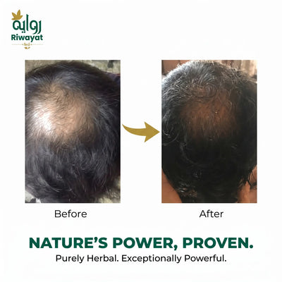 Riwayat Hair Revival Oil – Herbal Root Nourishing Hair Care Oil