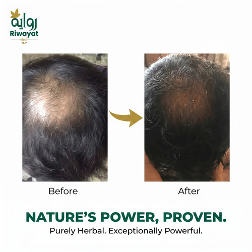 Riwayat Hair Revival Oil – Herbal Root Nourishing Hair Care Oil