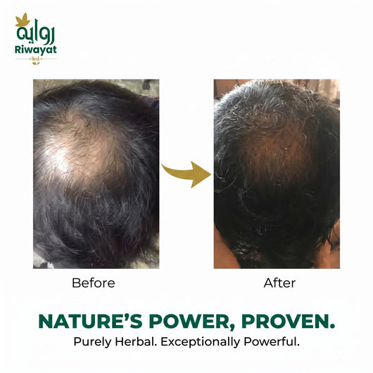 Riwayat Hair Revival Oil – Herbal Root Nourishing Hair Care Oil