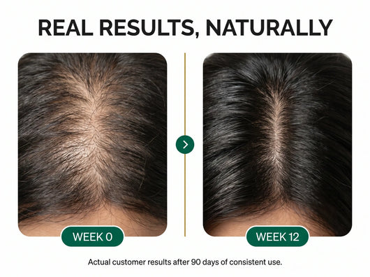 Riwayat Hair Revival Oil – Herbal Root Nourishing Hair Care Oil